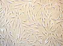 線維芽細胞の賦活の画像