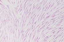 線維芽細胞の画像